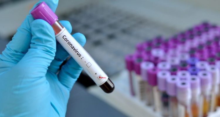 coronavirus_testing_web_news-780x470